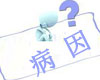 甲状腺功能亢进症病因