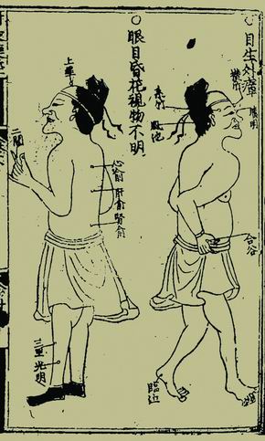 《针灸捷径》